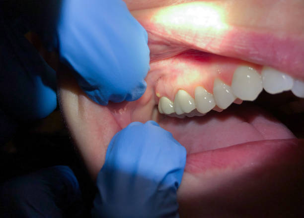 Best Pediatric Emergency Dentist in Urbana, MD