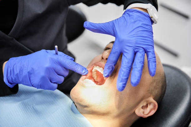Best Emergency Dentist for Knocked-Out Tooth in Urbana, MD