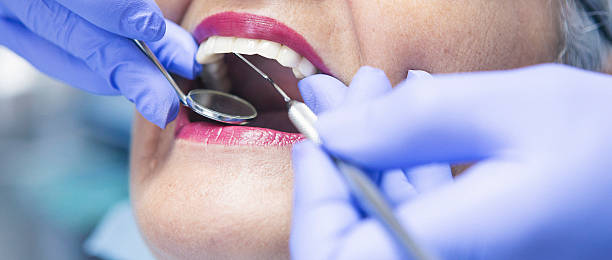 Best Emergency Root Canal Treatment in Urbana, MD